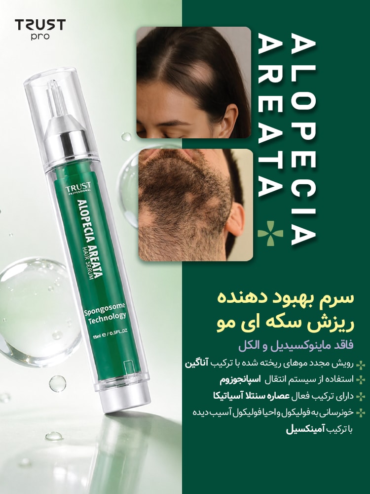 ALOPECIA